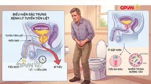 Phì đại tuyến tiền liệt: Hiểu đúng, điều trị sớm