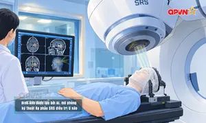 Hiệu quả của xạ trị, xạ phẫu trong điều trị u não phức tạp