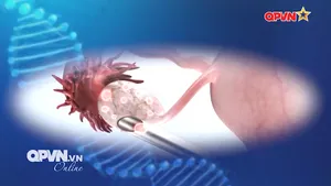 Thụ tinh trong ống nghiệm thất bại nhiều lần - Đừng vội tuyệt vọng