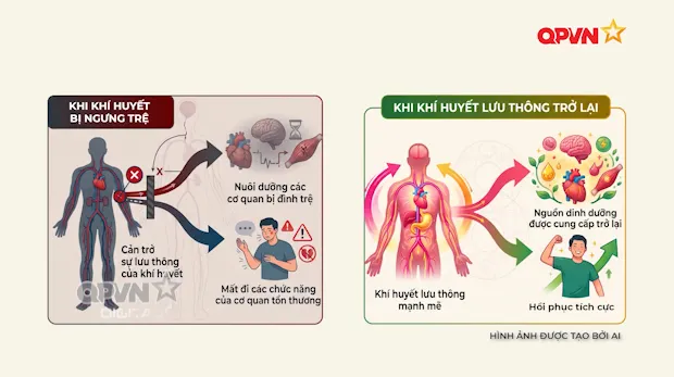 Phục hồi sau đột quỵ bằng Y học cổ truyền
